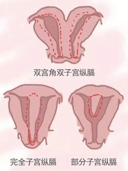 2026年单身女性在青岛附属医院做试管的费用高吗？大概需要多少钱？